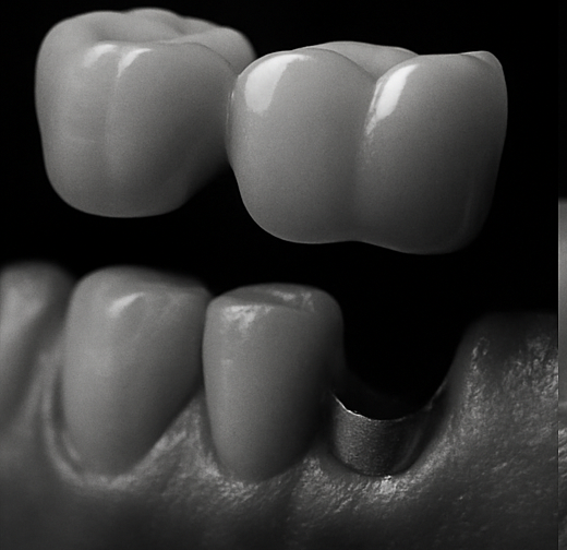 Endodonție